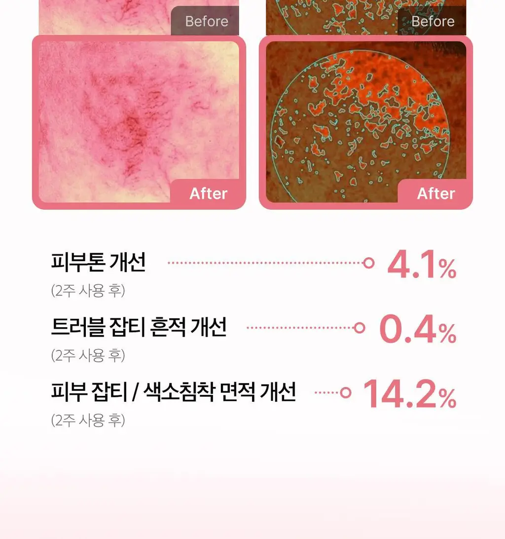[속건조수분크림] 메디큐브 PDRN 핑크 히알루로닉 수분크림 50ml 더블기획 (+앰플10ml) 상세페이지 12